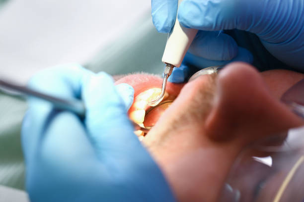 Best Walk-In Emergency Dentist in Port Dickinson, NY