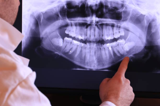 Best Emergency Treatment for Toothache in Port Dickinson, NY