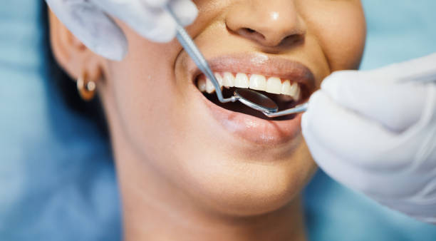 Best Emergency Broken Tooth Repair in Port Dickinson, NY